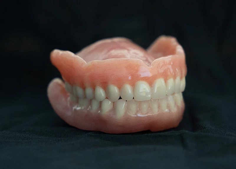 A conventional denture